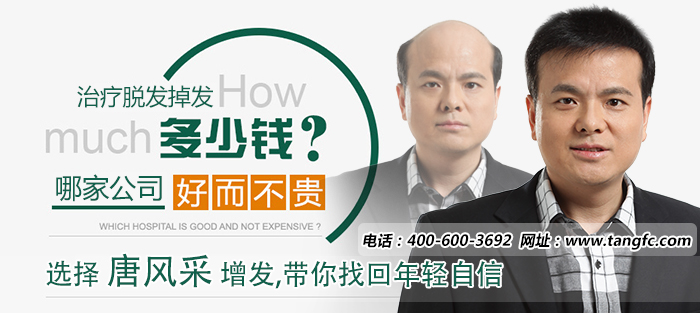 頭頂頭發(fā)稀疏怎么辦？怎樣可以防止脫發(fā)？